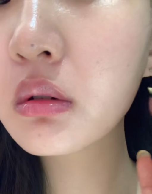 Patient skin condition before treatment close-up
