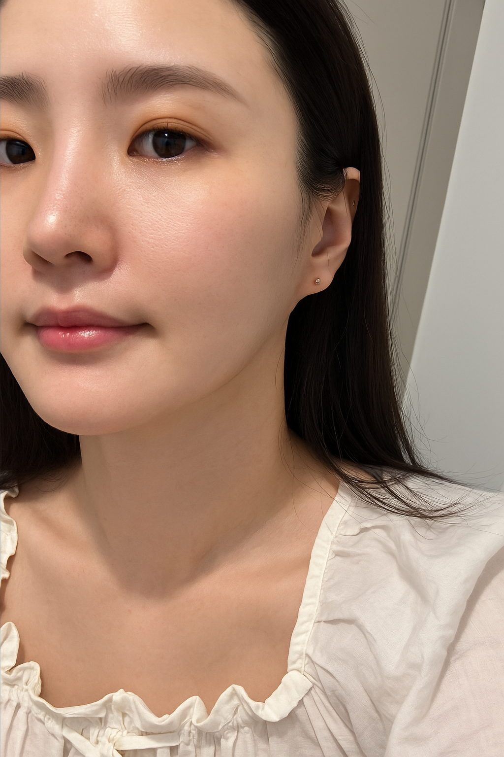 Skin result immediately after ONDA 20KJ face treatment