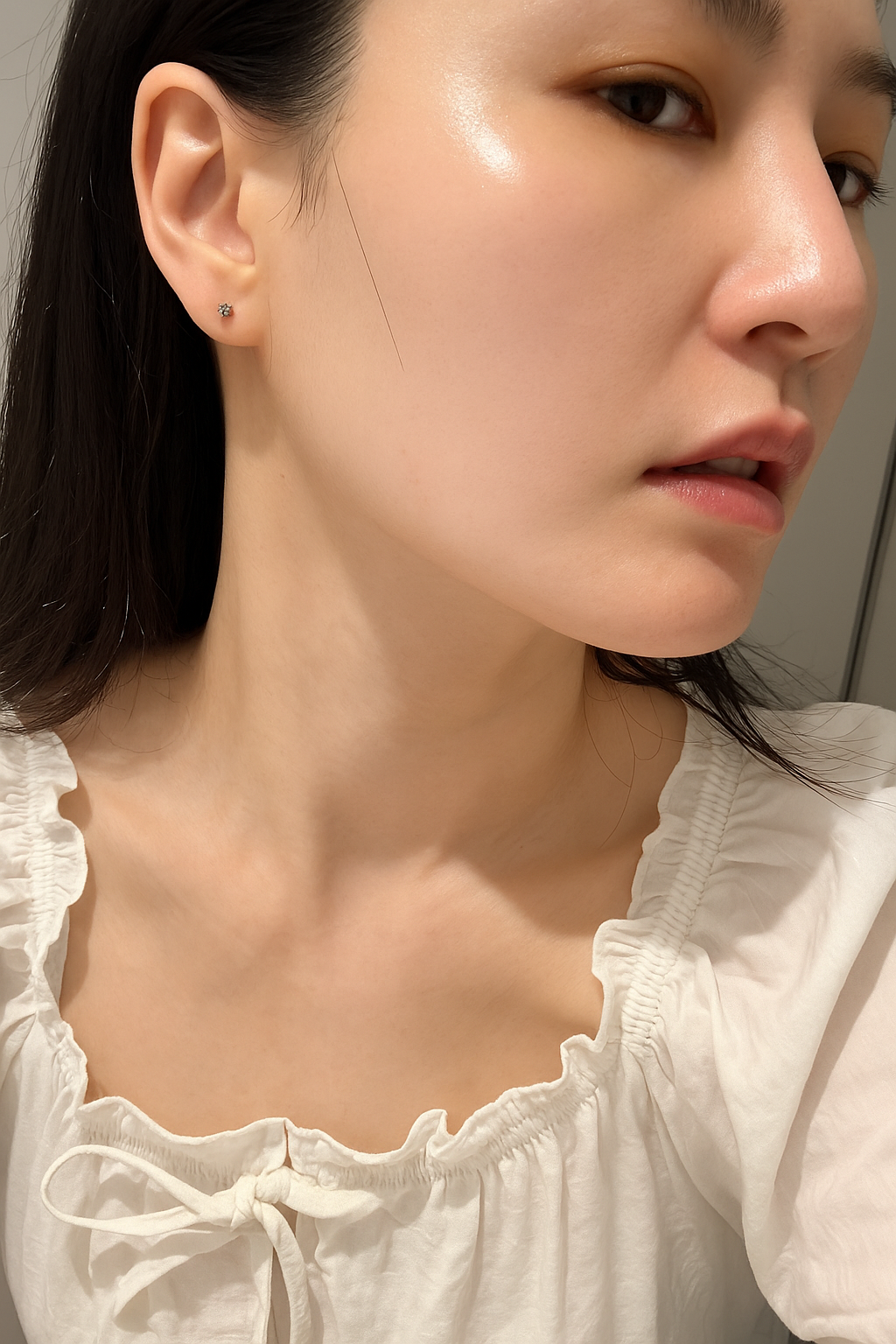 Side profile showing improved skin texture after ONDA treatment